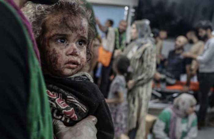 Mientras continúan los bombardeos de terror de Israel, la ONU alerta: Brotes de sarna, varicela y diarrea en Gaza. Análisis
